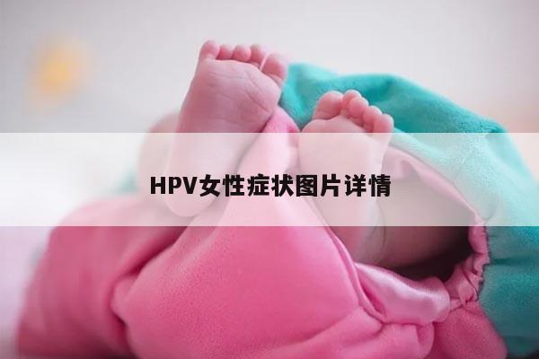 HPV女性症状图片详情